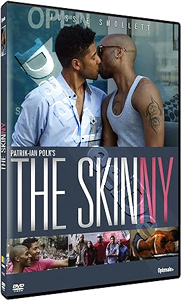 The Skinny |   DVD